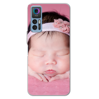 TCL  30 PLUS Funda  Personalizada